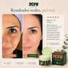 JIYU Pads Despigmentantes 100 UNDS