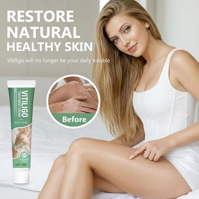 Crema Botánica Natural para Vitiligo