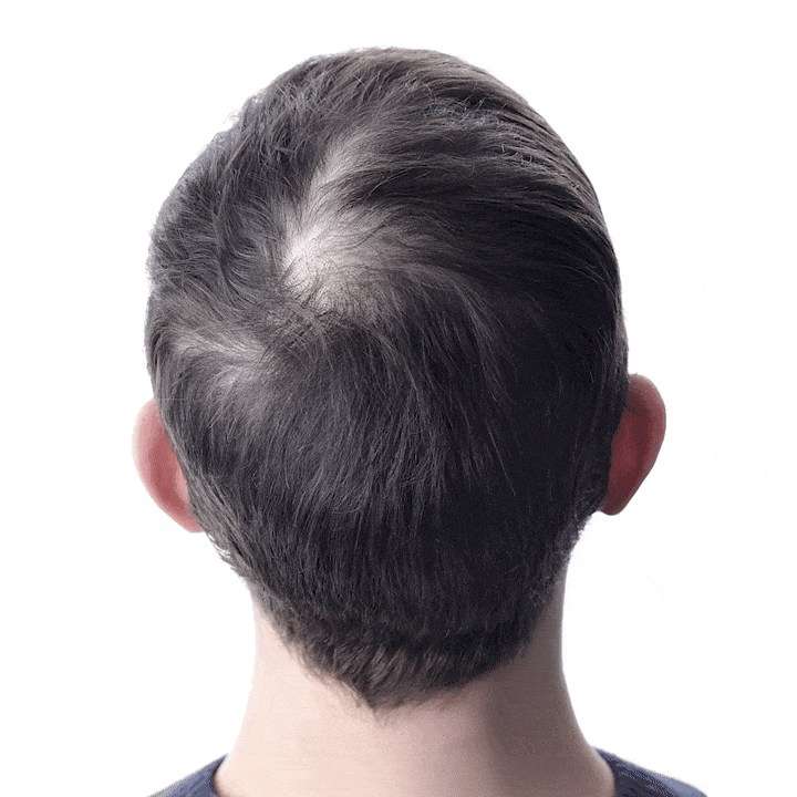 Aceite de Batana Puro