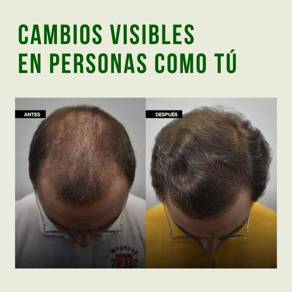 Aceite de Batana Puro