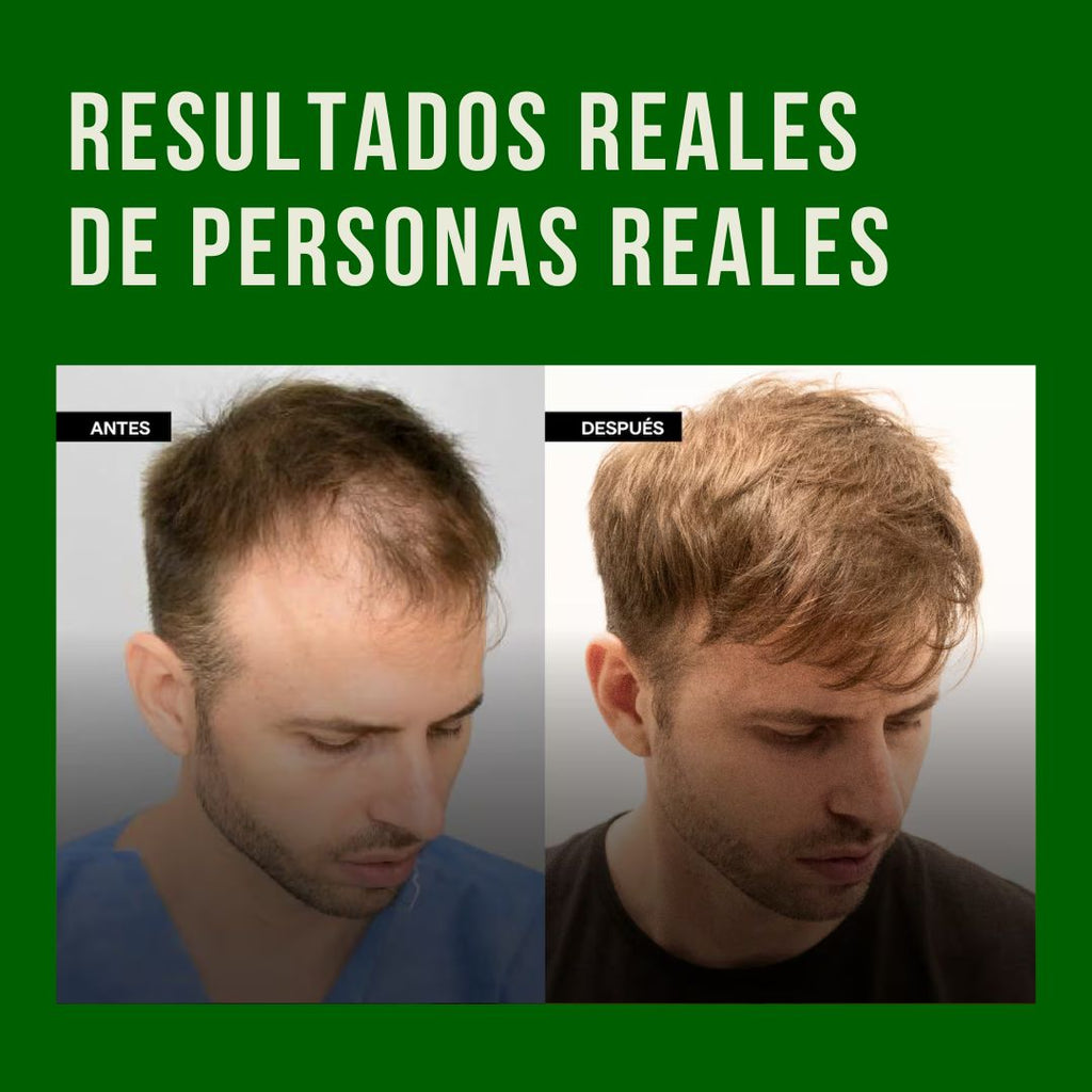 Aceite de Batana Puro