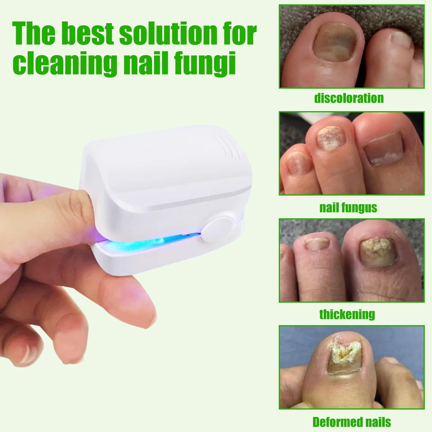 Laser Curador de Hongos