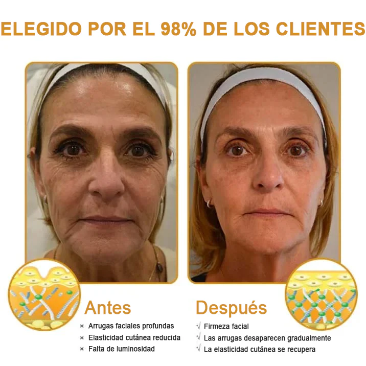 CREMA DE BOTOX VENENO DE ABEJA