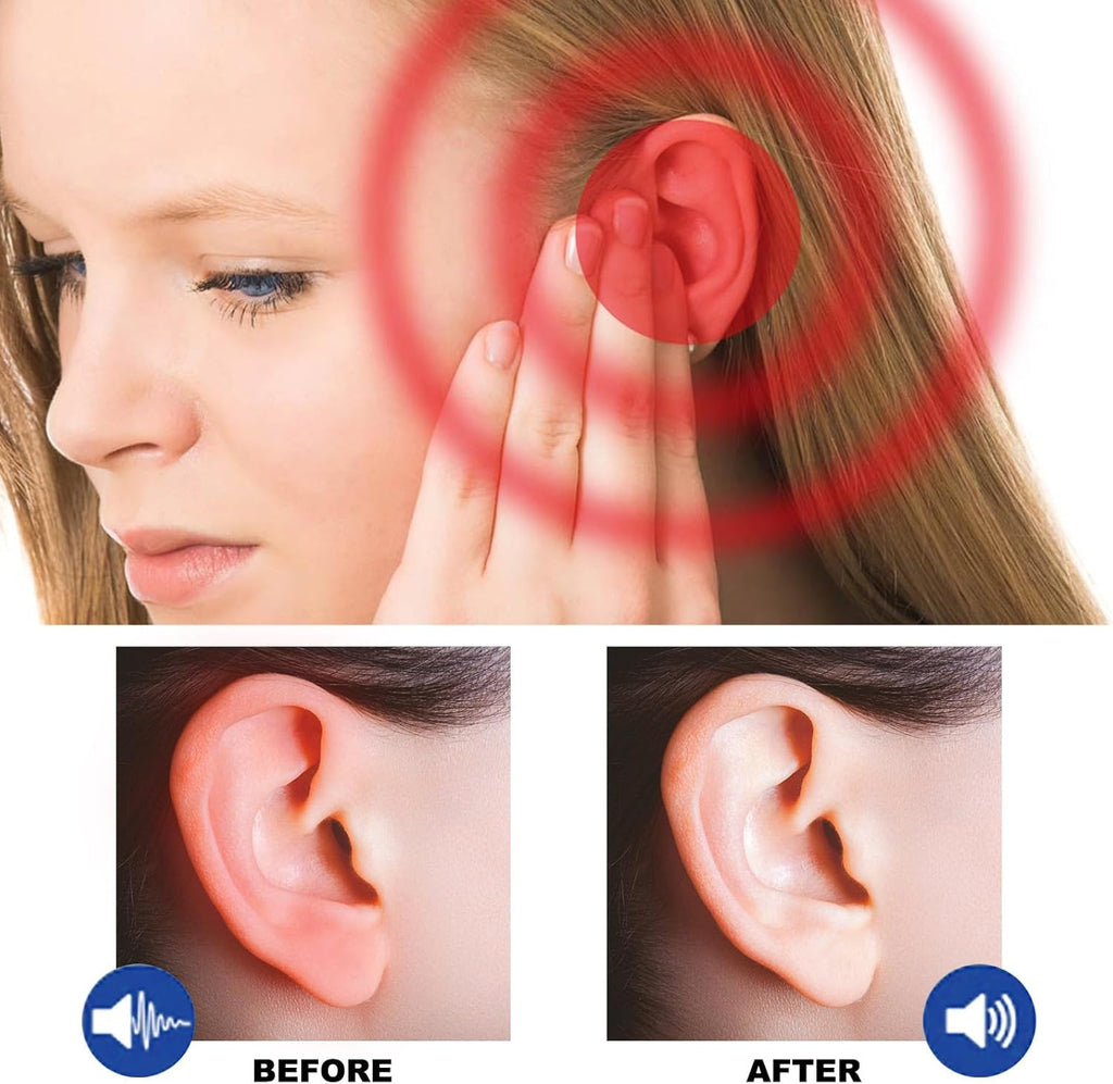 Spray Alivio del Tinnitus