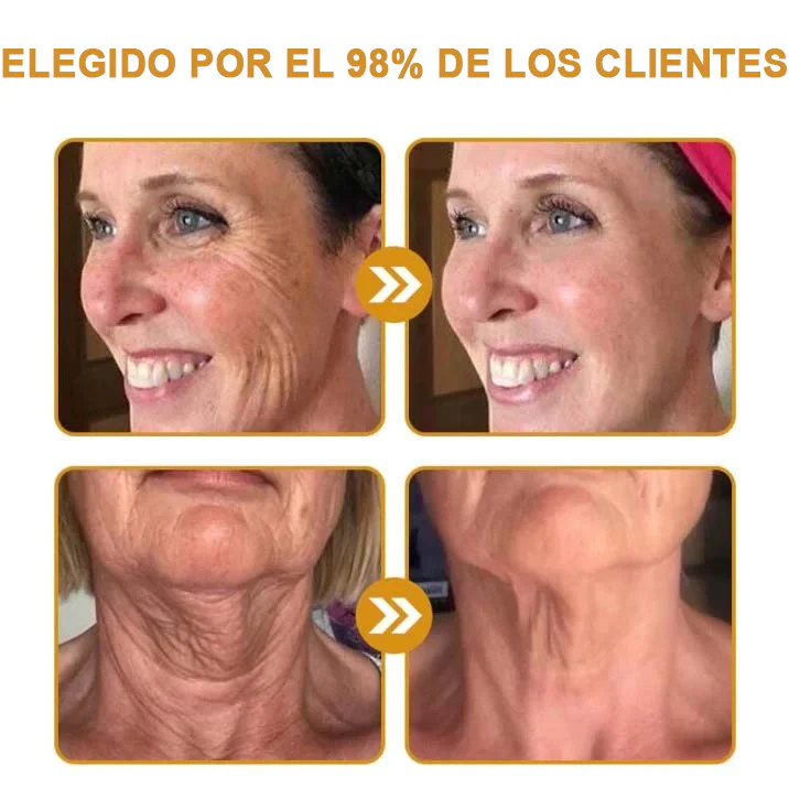 CREMA DE BOTOX VENENO DE ABEJA