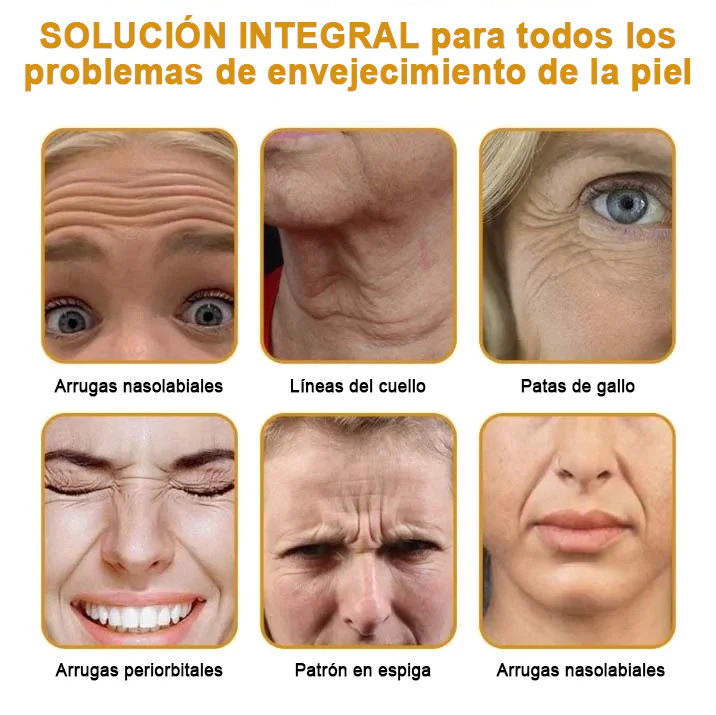 CREMA DE BOTOX VENENO DE ABEJA